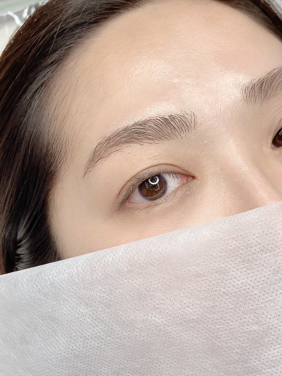 보니떼 이미지