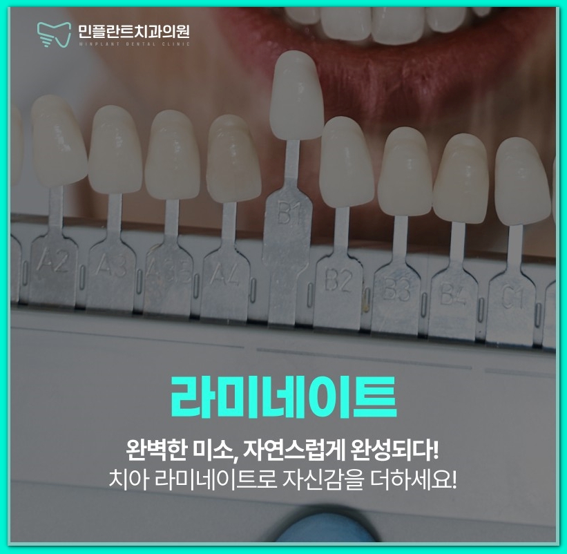 민플란트치과의원 이미지