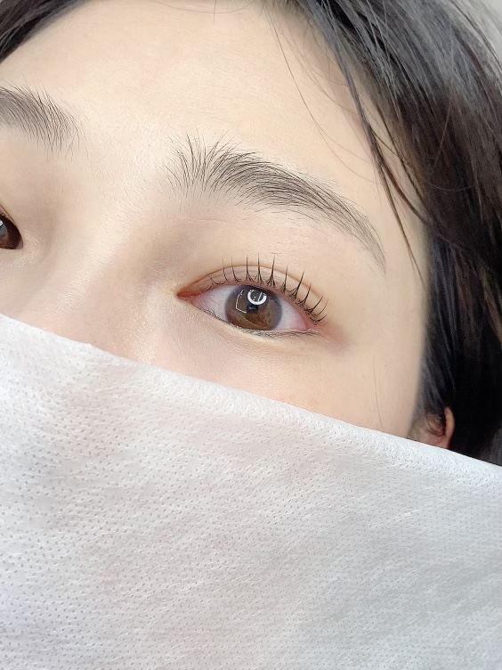 보니떼 이미지