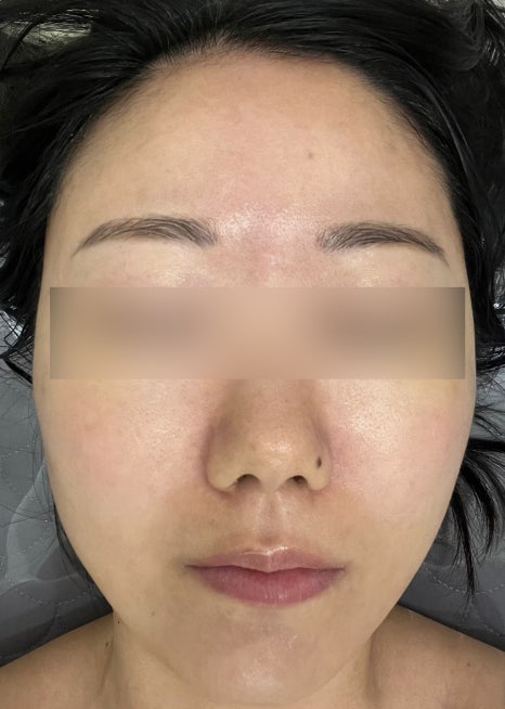 타이팅 메디케어 스킨앤바디 이미지