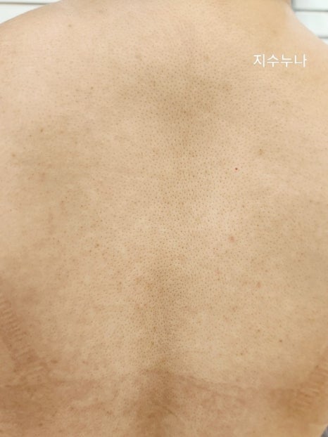 홍바디케어 이미지
