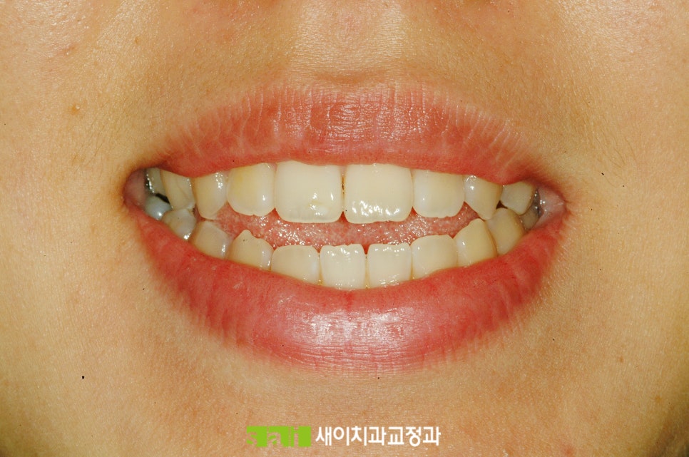 새이치과교정과치과의원 이미지