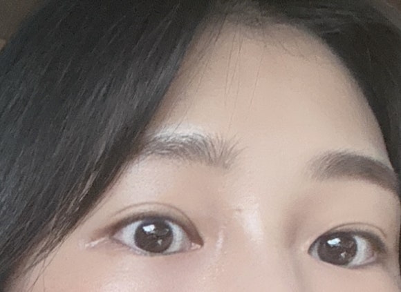 보니떼 이미지