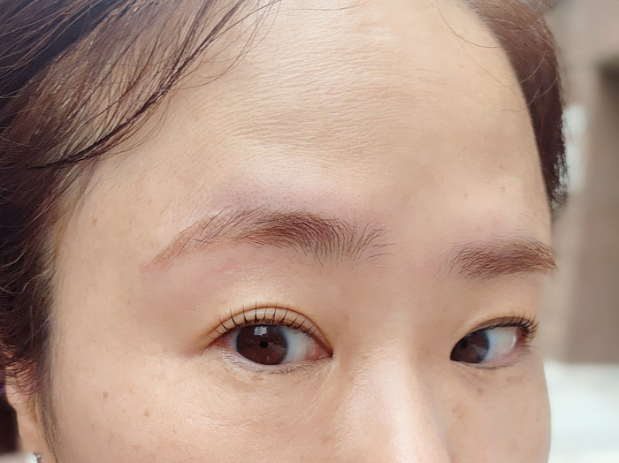 보니떼 이미지