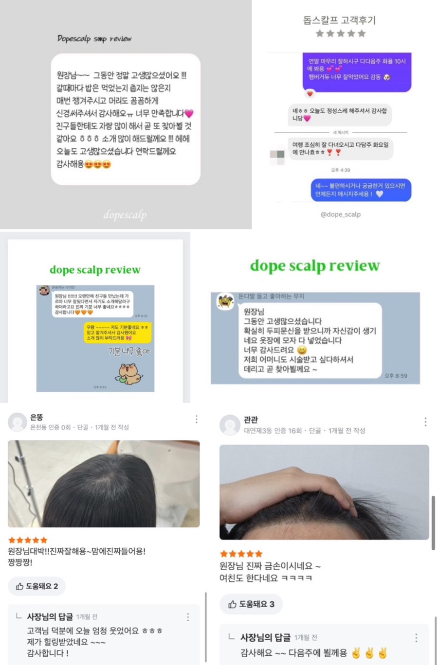 돕스칼프 이미지