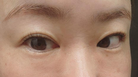 보니떼 이미지