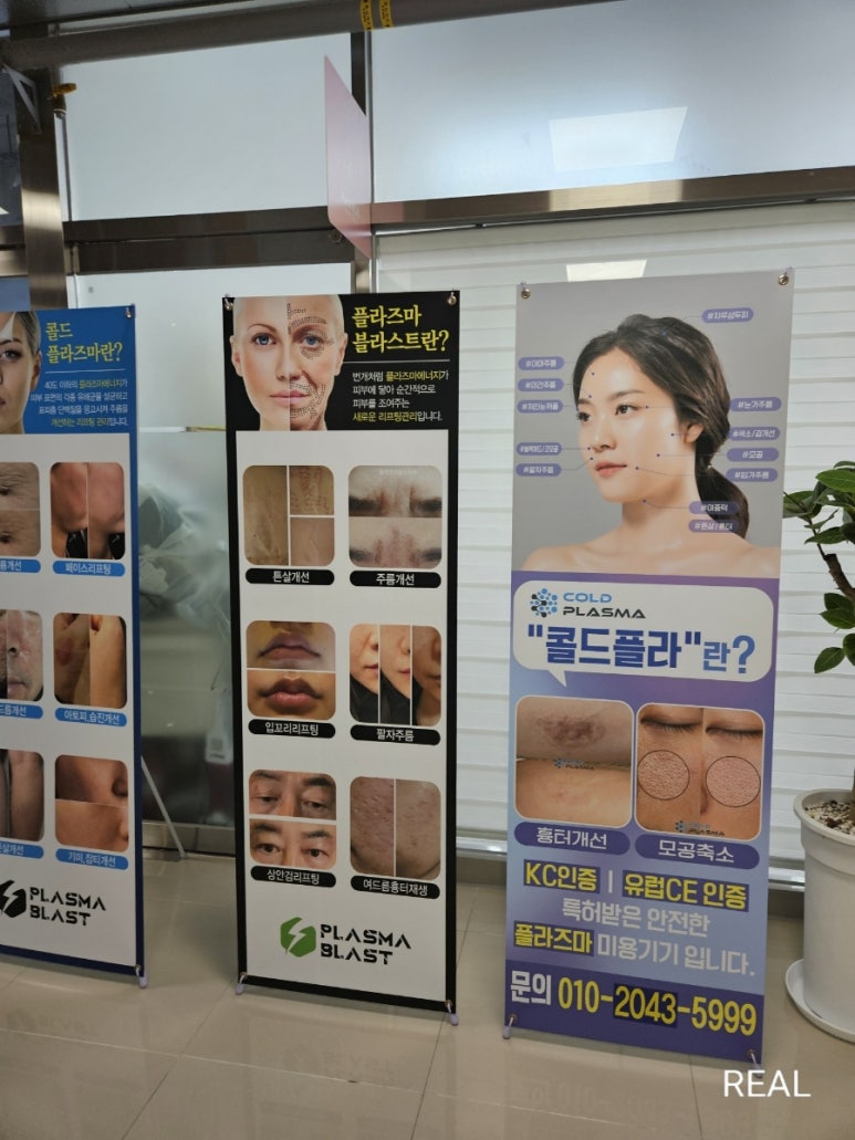 아우라 플라즈마 이미지