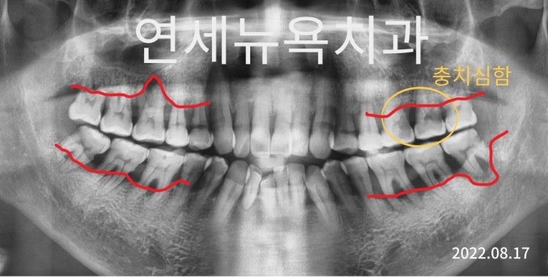 미아연세치과 이미지