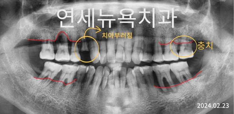 미아연세치과 이미지