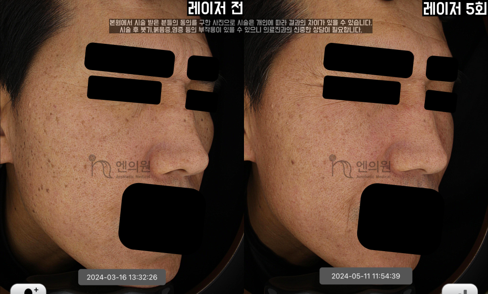 엔의원 이미지