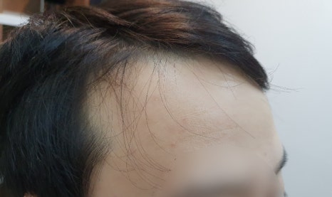 조이모 이미지