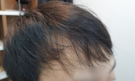 조이모 이미지