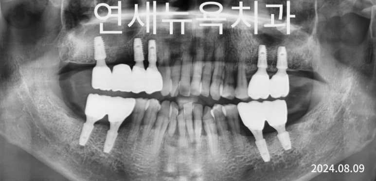 미아연세치과 이미지