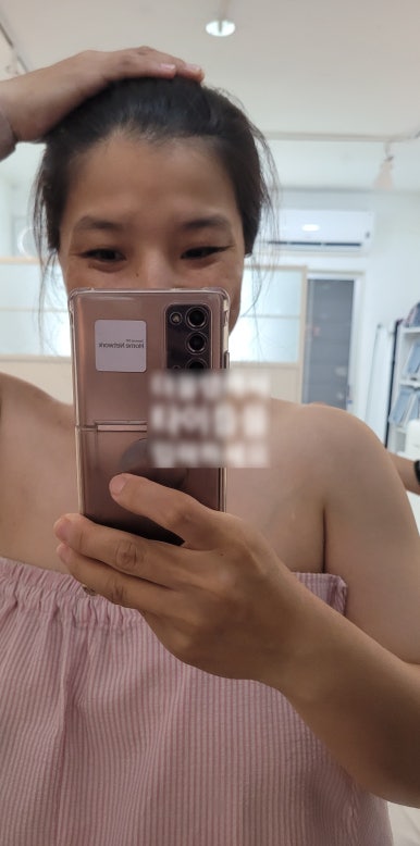 피부아지트(뉴페이스) 이미지