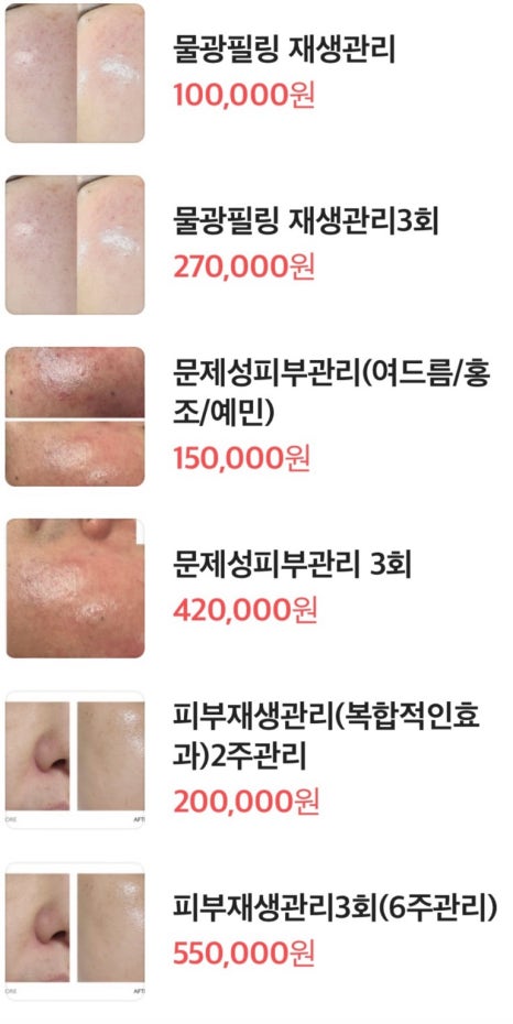 솜이 뷰티 이미지