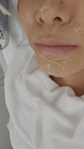 아누보스킨 이미지