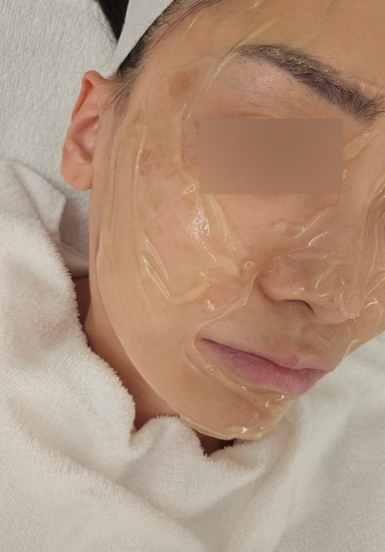 아누보스킨 이미지