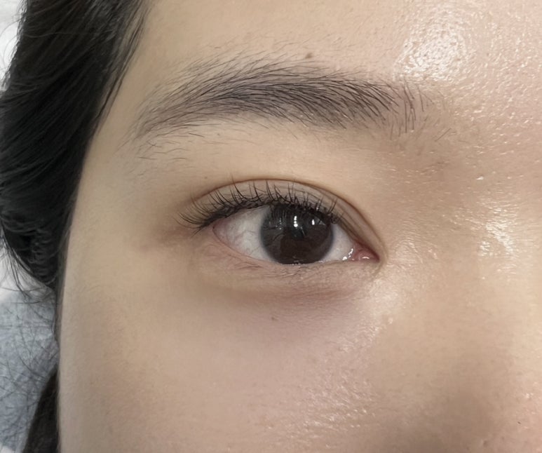 수인래쉬 이미지