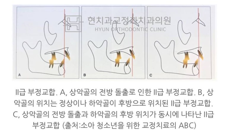 현치과교정과치과의원 이미지