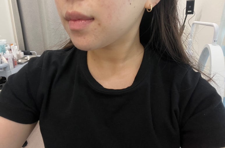타이팅 메디케어 스킨앤바디 이미지