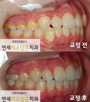 연세미소담은치과 이미지