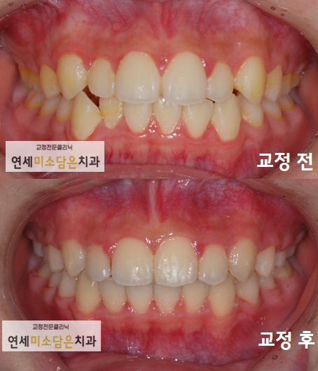연세미소담은치과 이미지