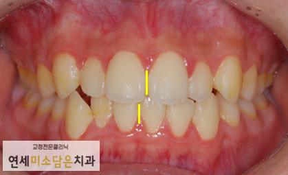 연세미소담은치과 이미지
