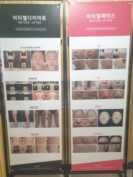 비티엘플러스 이미지