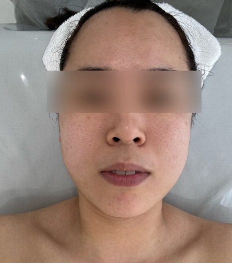 블랑드보떼 이미지