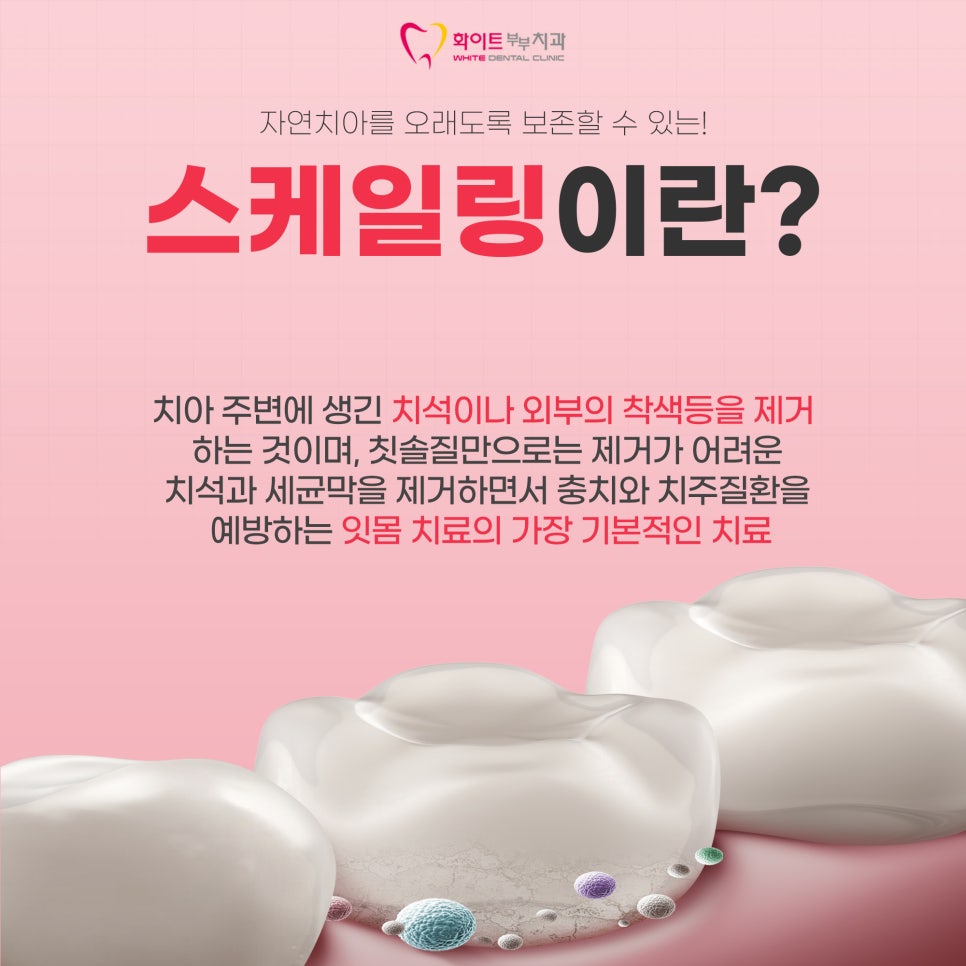 청양부부치과 이미지