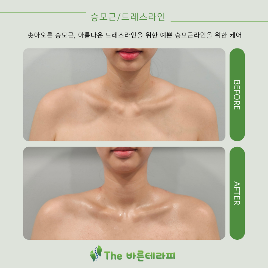 더바른테라피 이미지