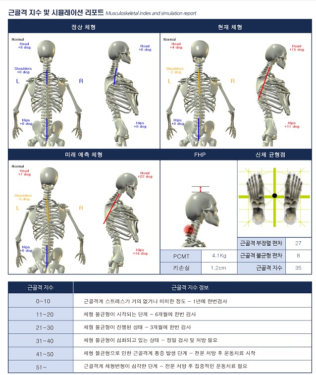 리픽스 이미지