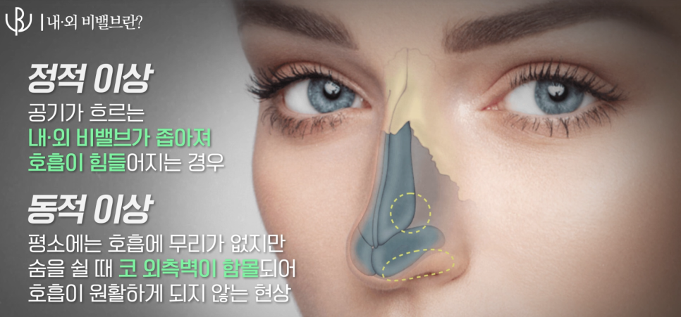 비앤영의원 이미지