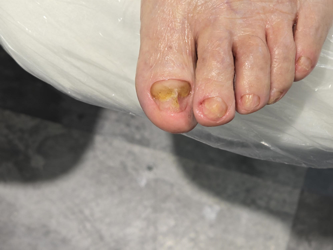 푸스케어 롯데마트제천점 이미지