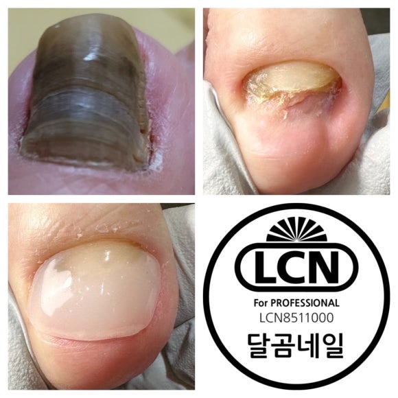 달곰네일 이미지