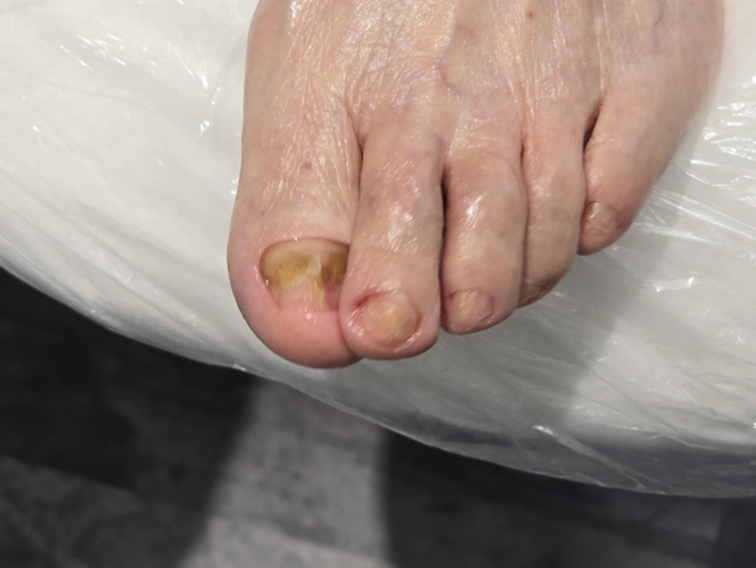 푸스케어 롯데마트제천점 이미지