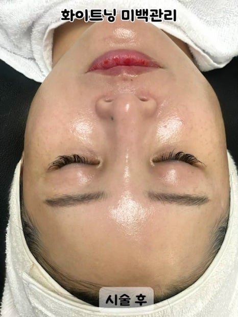 하영피부관리 이미지