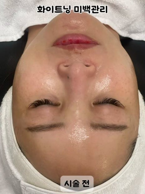 하영피부관리 이미지
