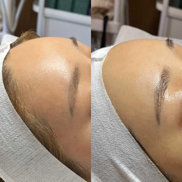 이노 스킨케어 이미지