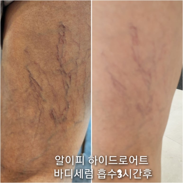 클라운지 이미지
