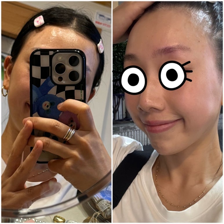스파로제 이미지
