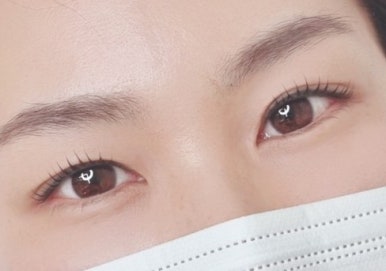 테라스 인 스킨 이미지