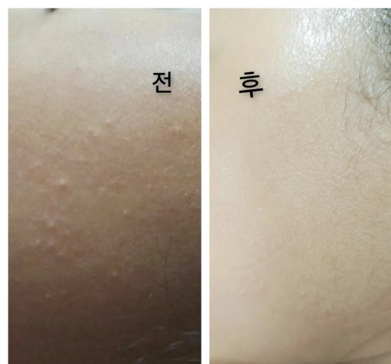 오늘은밝은피부 이미지