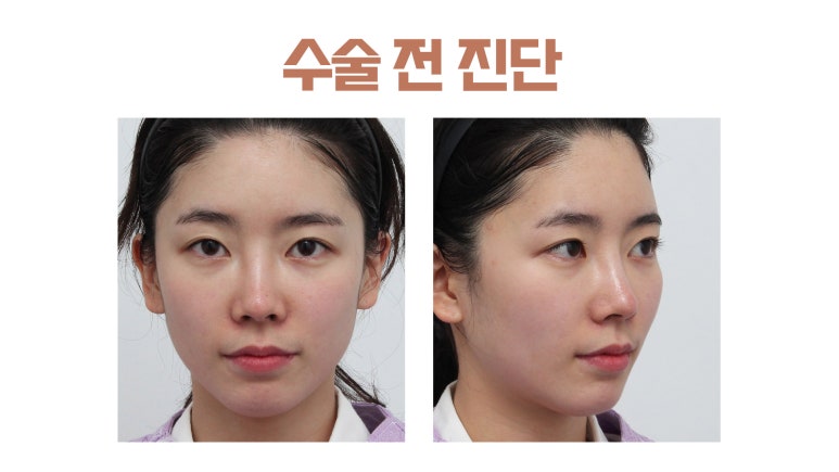 더아름다운성형외과의원 이미지
