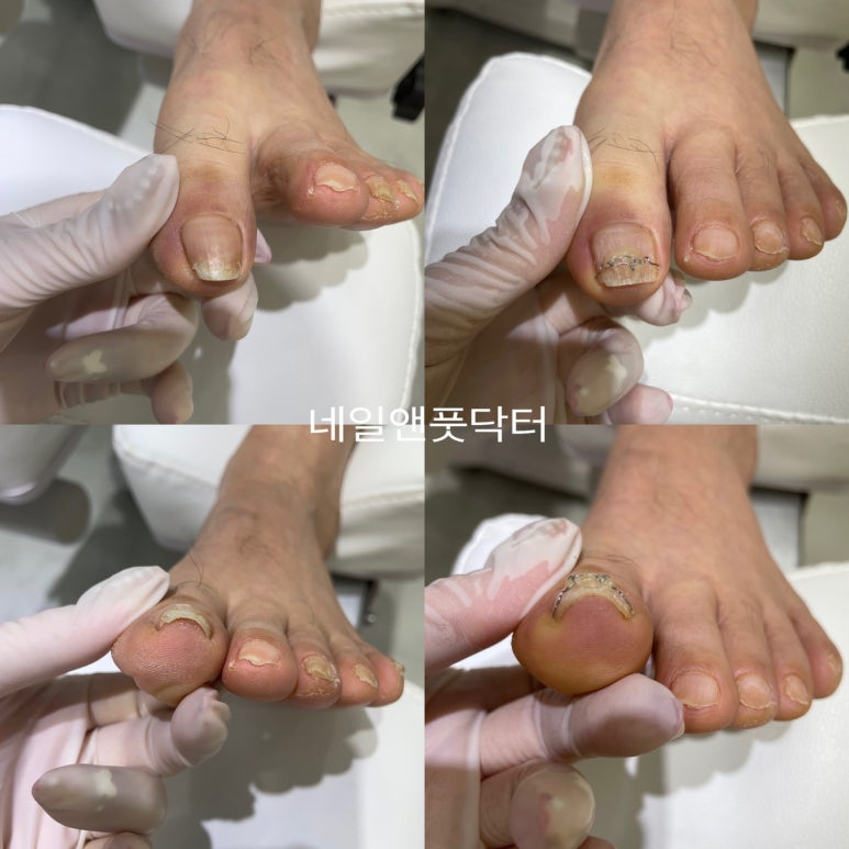 네일앤풋닥터 이미지