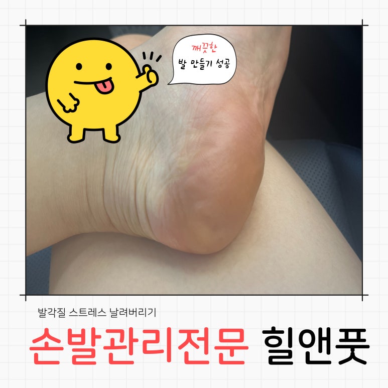 힐앤풋 이미지