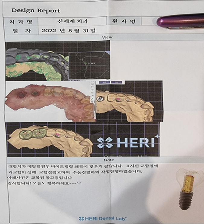 덴탈시스템 이미지