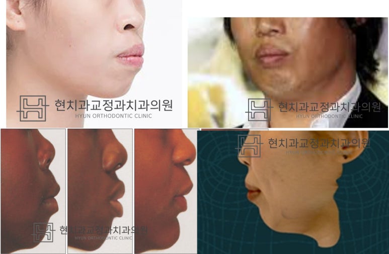 현치과교정과치과의원 이미지