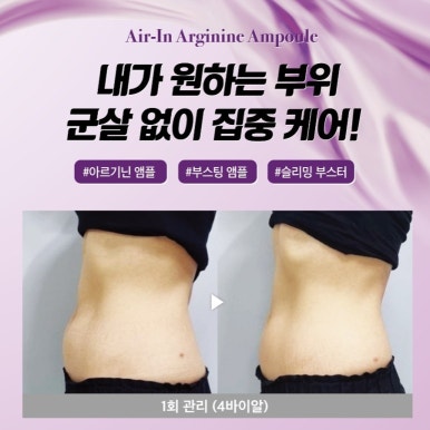 보에스테틱 이미지