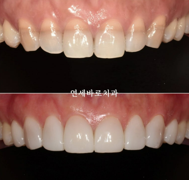 젤라 이미지
